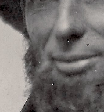 Mole Examination — enlarged and lightened area of the character's cheek